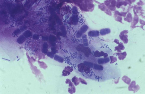 Cytologibloggen fig 4-1